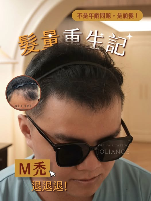 JoliAnge 髮際線設計