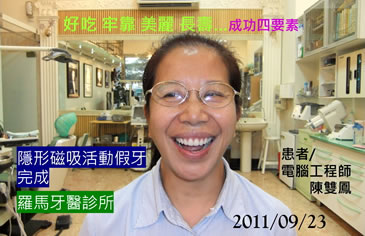 患者陳雙鳳,2011/09/23 隱形磁吸活動假牙完成